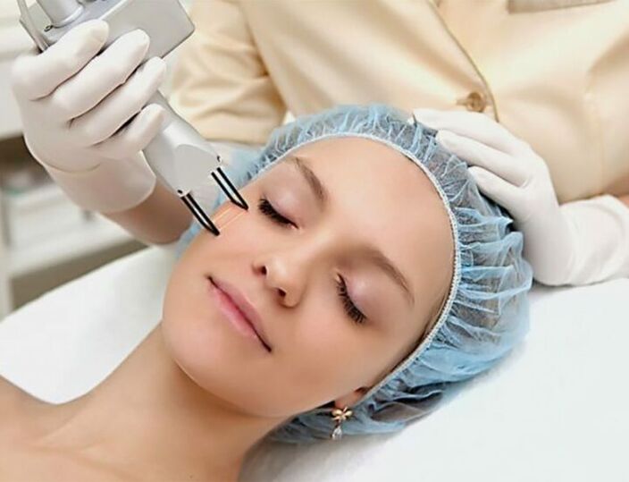 Azione laser frazionata sulla pelle del viso per un delicato ringiovanimento