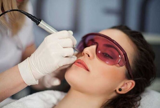 Bioristizzazione laser